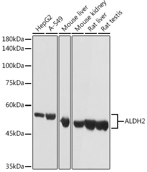 ALDH2 antibody