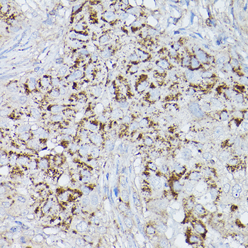 ALDH2 antibody