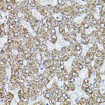 ALDH2 antibody