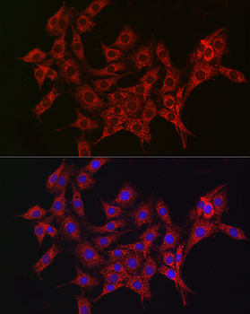 ALDH2 antibody