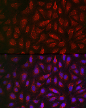 ALDH2 antibody