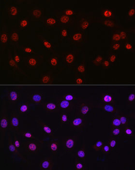 DDX39A antibody