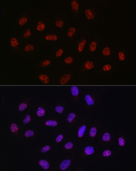 DDX39A antibody