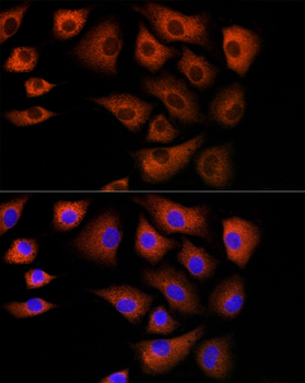 DBI antibody