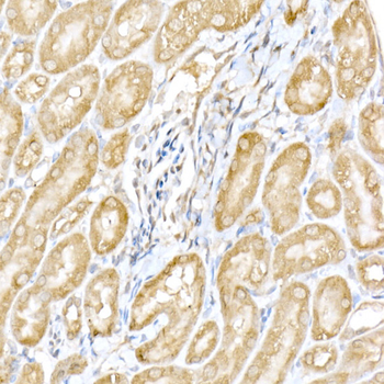 RNF126 antibody