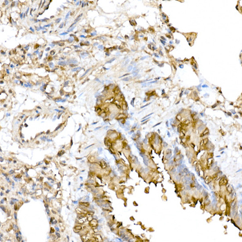 RNF126 antibody