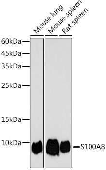 S100A8 antibody