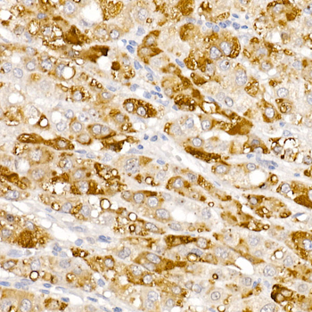 HSD17B13 antibody