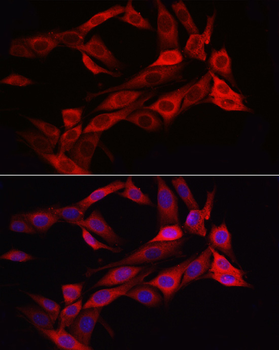 ASNS antibody