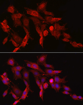 ASNS antibody