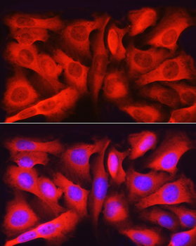 ASNS antibody