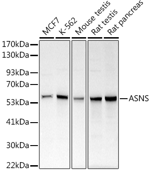 ASNS antibody