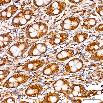 NBR1 antibody