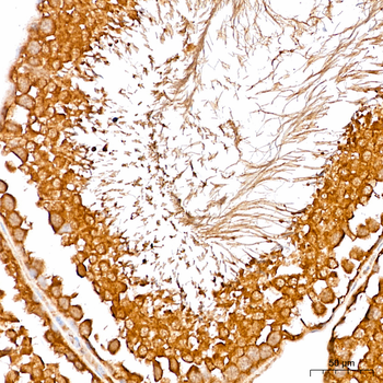 NBR1 antibody