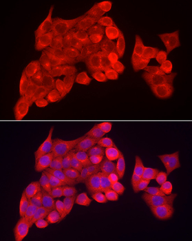 INPP5K antibody