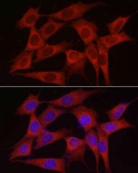 INPP5K antibody