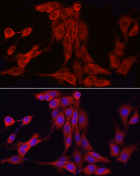 INPP5K antibody