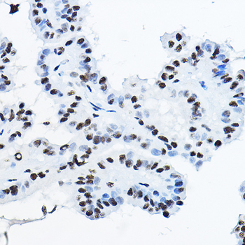 NONO/p54nrb antibody