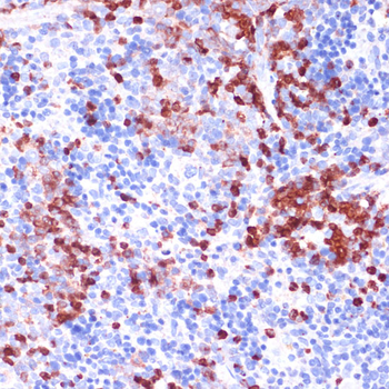 WIPF1 antibody