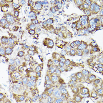 LLGL1 antibody