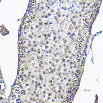 Casein Kinase 2 beta (CSNK2B) antibody