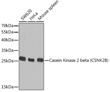 Casein Kinase 2 beta (CSNK2B) antibody