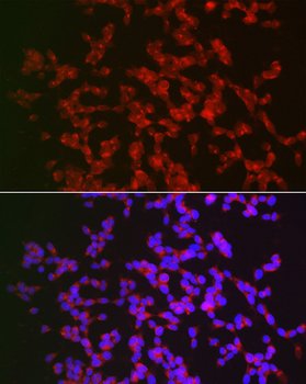 CAMK4 antibody