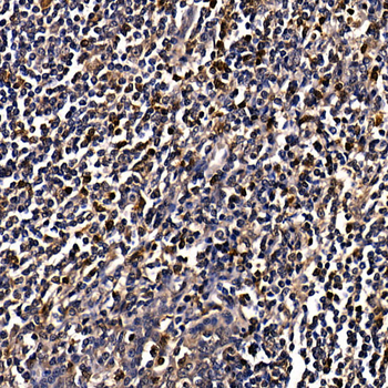 CAMK4 antibody