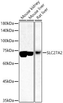 SLC27A2 antibody