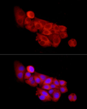 SLC27A2 antibody