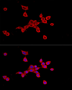 SLC27A2 antibody