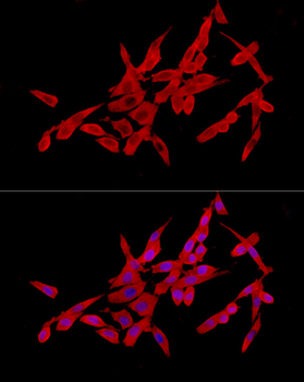 SLC27A2 antibody