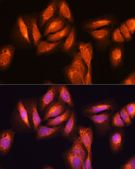 NFkB p65 antibody