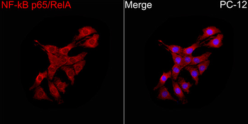 NFkB p65 antibody