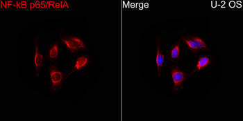 NFkB p65 antibody