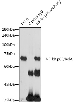 NFkB p65 antibody