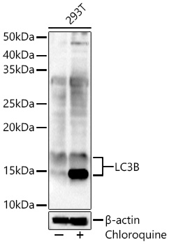 MAP1LC3B antibody