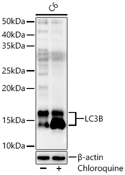 MAP1LC3B antibody