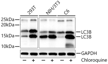 MAP1LC3B antibody