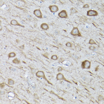 MAP1LC3B antibody