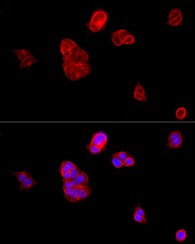 CDH1 antibody