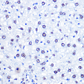 CHD4 antibody