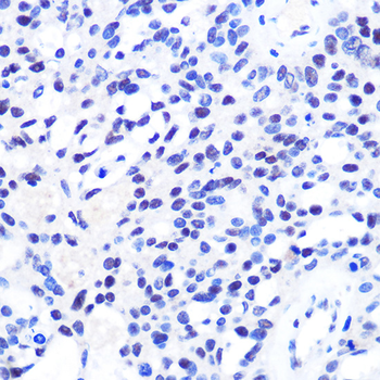 CHD4 antibody