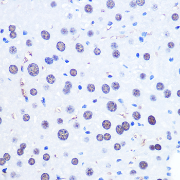 CHD4 antibody