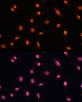 CHD4 antibody