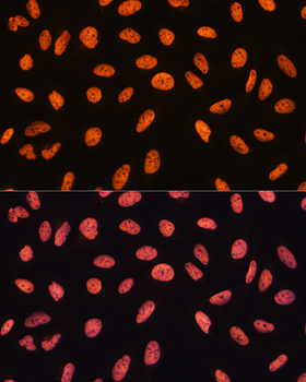 CHD4 antibody