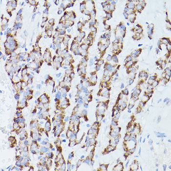 RPS18 antibody