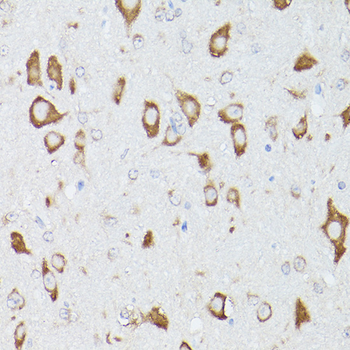 RPS18 antibody