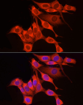 RPS18 antibody