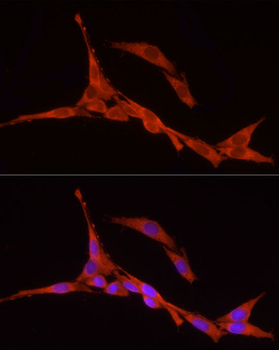 RPS18 antibody